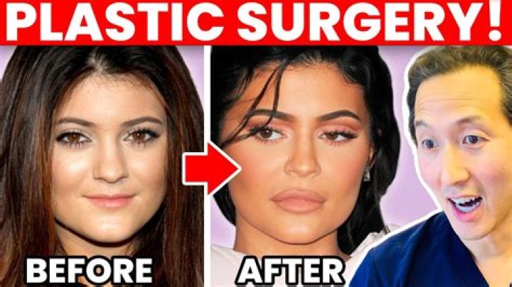 A Visual Guide To Plastic Surgery Transformations