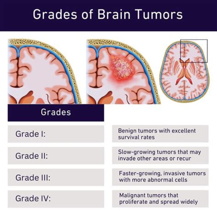 Resilience Amidst a Brain Tumor Diagnosis